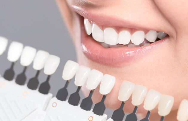 prevenzione ed interventi per un sorriso ed una sicurezza dentale-studio-sabiu
